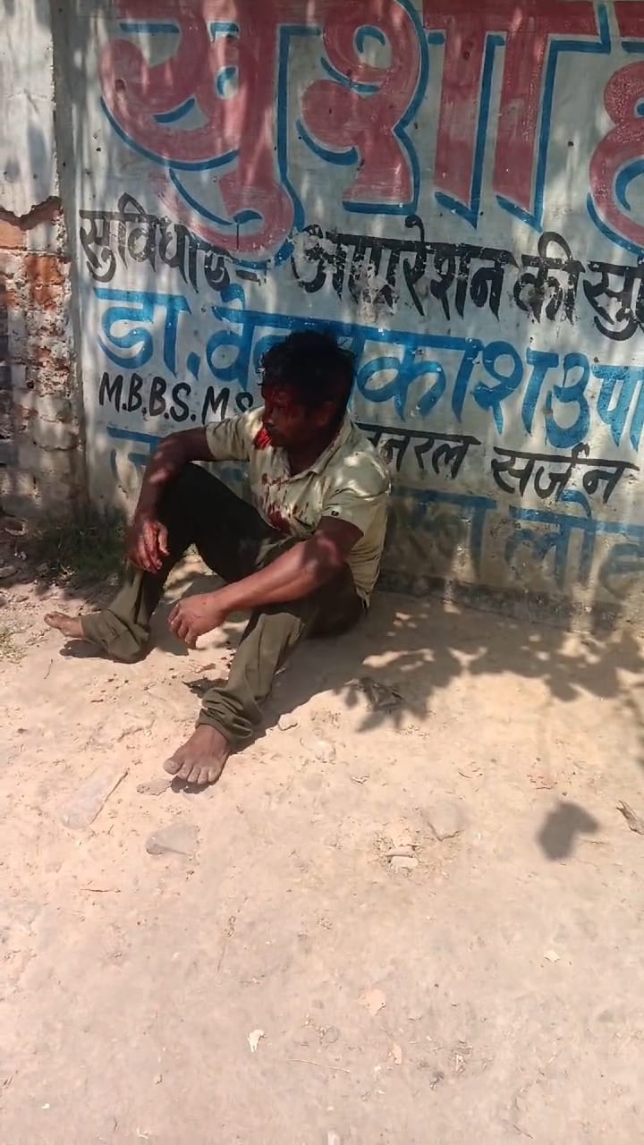 You are currently viewing ट्रेन के आगे कूदकर आत्महत्या का प्रयास, युवक गंभीर रूप से घायल